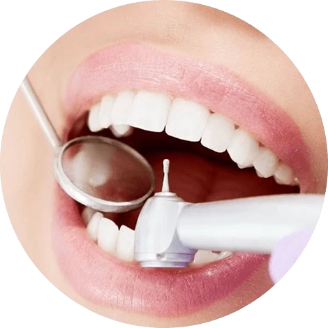 Баннер Лечение кариеса Баннер Лечение кариеса